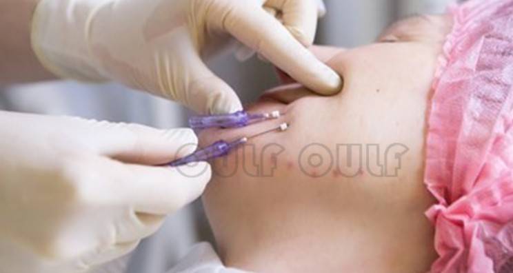 線雕最新手法，背景、發(fā)展、時(shí)代地位及展望